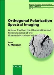 Tapa de Orthogonal Polarization Spectral Imaging: A New Tool for the Observation and Measurement of the Human Microcirculation