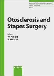 Tapa de Otosclerosis and stapes surgery