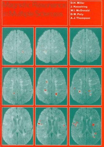 Tapa de Magnetic resonance in multiple sclerosis