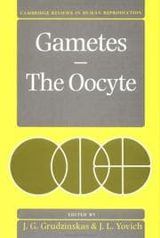 Tapa de Gametes