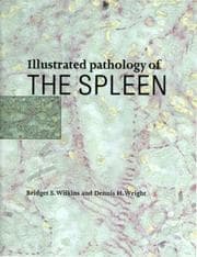 Tapa de Illustrated pathology of the spleen