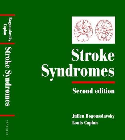 Tapa de Stroke Syndromes