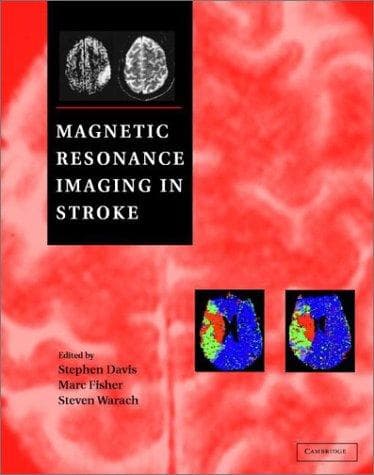 Tapa de Magnetic Resonance Imaging in Stroke