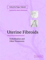 Tapa de Uterine Fibroids