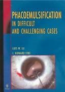 Tapa de Phacoemulsification in difficult and challenging cases