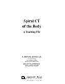 Tapa de Spiral CT of the body