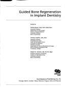 Tapa de Guided bone regeneration in implant dentistry