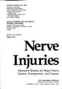 Tapa de Nerve injuries