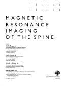 Tapa de Magnetic resonance imaging of the spine