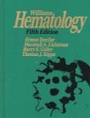 Tapa de Williams hematology
