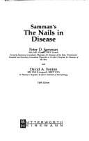 Tapa de Samman's the nails in disease