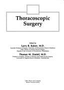 Tapa de Thoracoscopic surgery