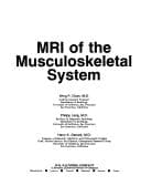 Tapa de MRI of the musculoskeletal system