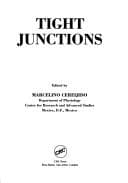 Tapa de Tight junctions