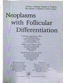 Tapa de Neoplasms with follicular differentiation