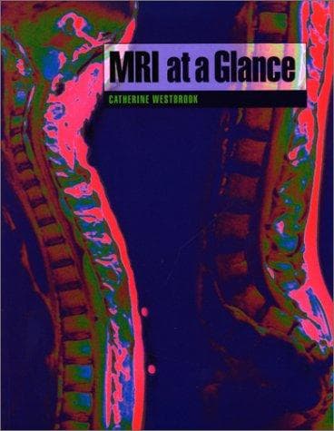 Tapa de MRI at a Glance