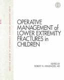 Tapa de Operative management of lower extremity fractures in children