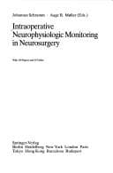 Tapa de Intraoperative neurophysiologic monitoring in neurosurgery