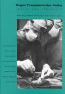 Tapa de Organ transplantation policy