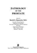 Tapa de Pathology of the prostate