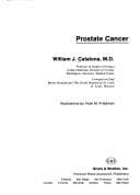 Tapa de Prostate cancer
