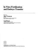 Tapa de In vitro fertilization and embryo transfer