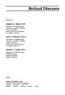 Tapa de Retinal diseases