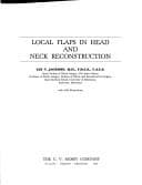 Tapa de Local flaps in head and neck reconstruction