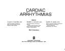 Tapa de Cardiac arrhythmias