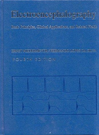 Tapa de Electroencephalography