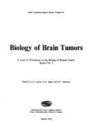 Tapa de Biology of brain tumors