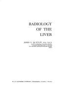 Tapa de Radiology of the liver