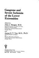 Tapa de Gangrene and severe ischemia of the lower extremities
