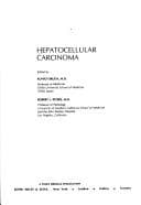 Tapa de Hepatocellular carcinoma