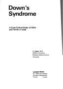 Tapa de Down's syndrome