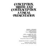 Tapa de Conception, birth, and contraception