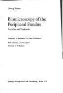 Tapa de Biomicroscopy of the peripheral fundus