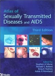 Tapa de Atlas of Sexually Transmitted Diseases and AIDS