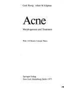 Tapa de Acne