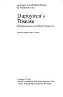 Tapa de Dupuytren's disease