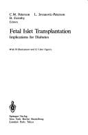 Tapa de Fetal Islet Transplantation