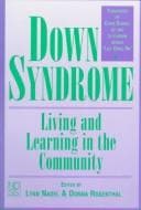 Tapa de Down syndrome