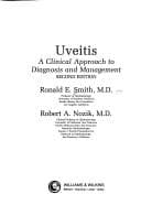 Tapa de Uveitis