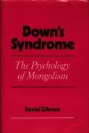 Tapa de Down's syndrome