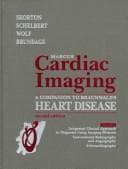 Tapa de Marcus cardiac imaging