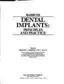 Tapa de Dental Implants