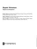 Tapa de Hepatic Metastases