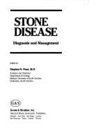 Tapa de Stone disease
