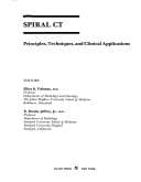 Tapa de Spiral CT