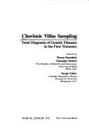 Tapa de Chorionic villus sampling